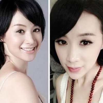 “天然美女代妈”与“人造美女代妈”的故事