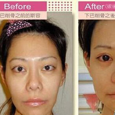 “天然美女代妈”与“人造美女代妈”的故事