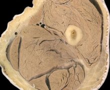 代妈生殖器官医学切片