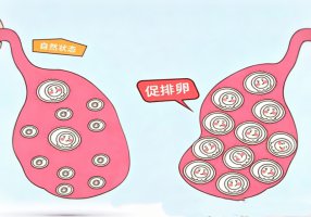 促排卵会让卵巢“早衰”吗？